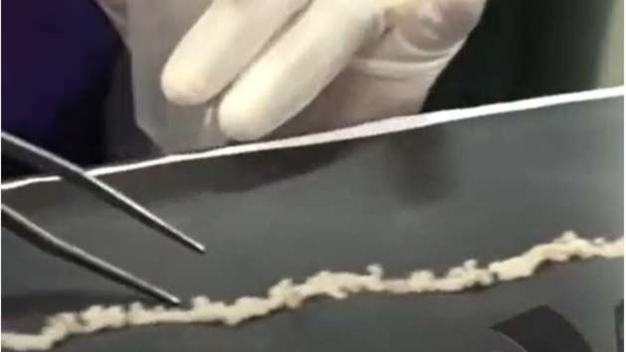 Dhuniyeyge emme dhigu tapeworm Lanka kuhjehgge hashigandun fenihjje