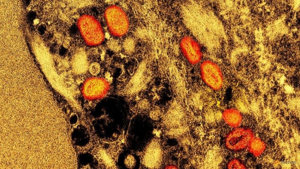 Droplets a 'minor' route for mpox transmission: WHO
