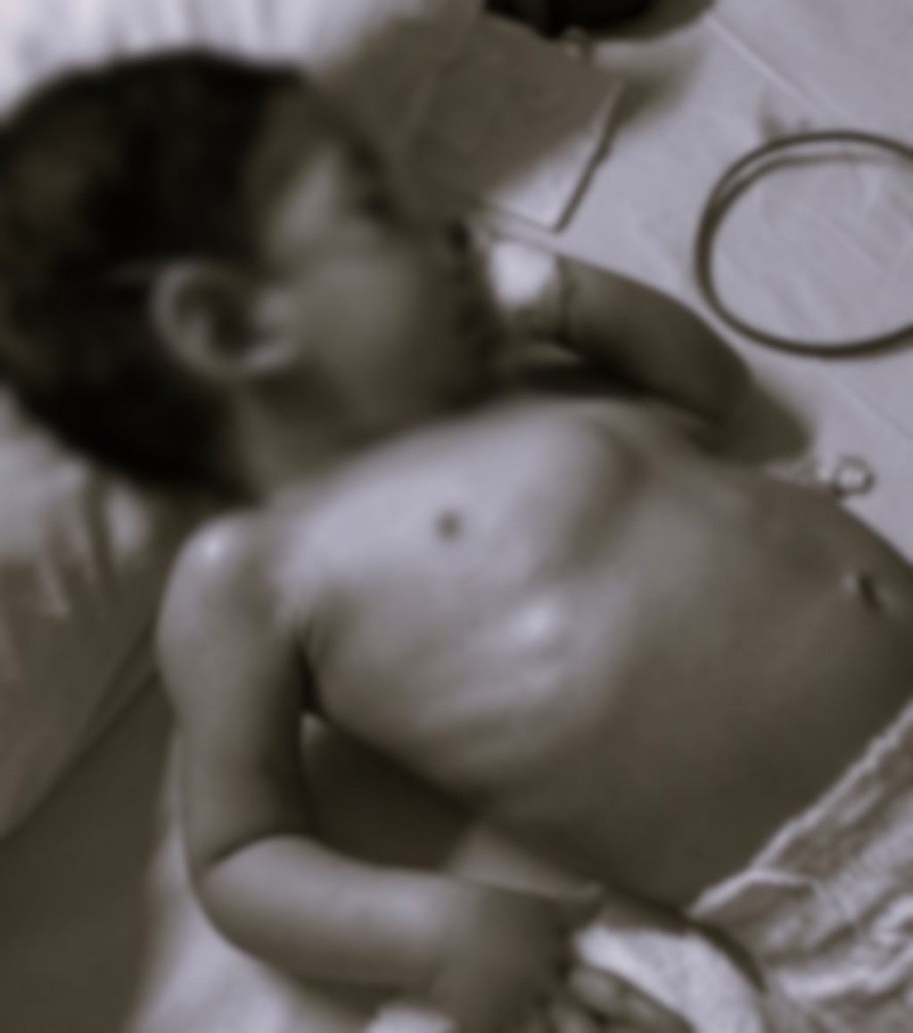 Umurun enme 2 aharu, 3 vana faharah pneumonia jehi aanmunge eheeah!