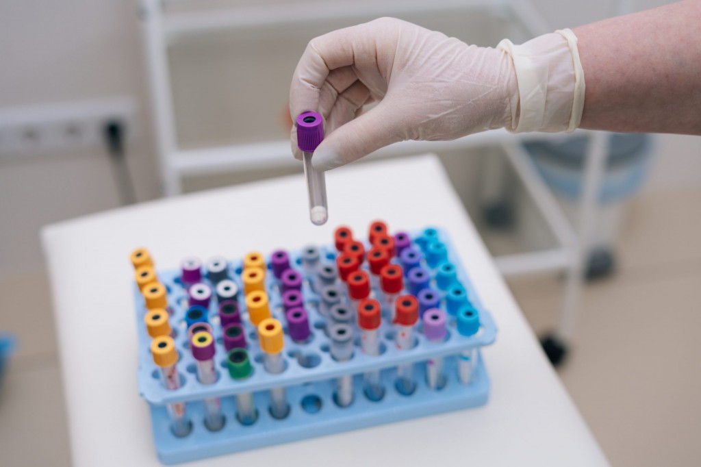 Oxford in ufahdhaa HIV vaccine ge ajuma belumuge thahuleelu thah fashaifi