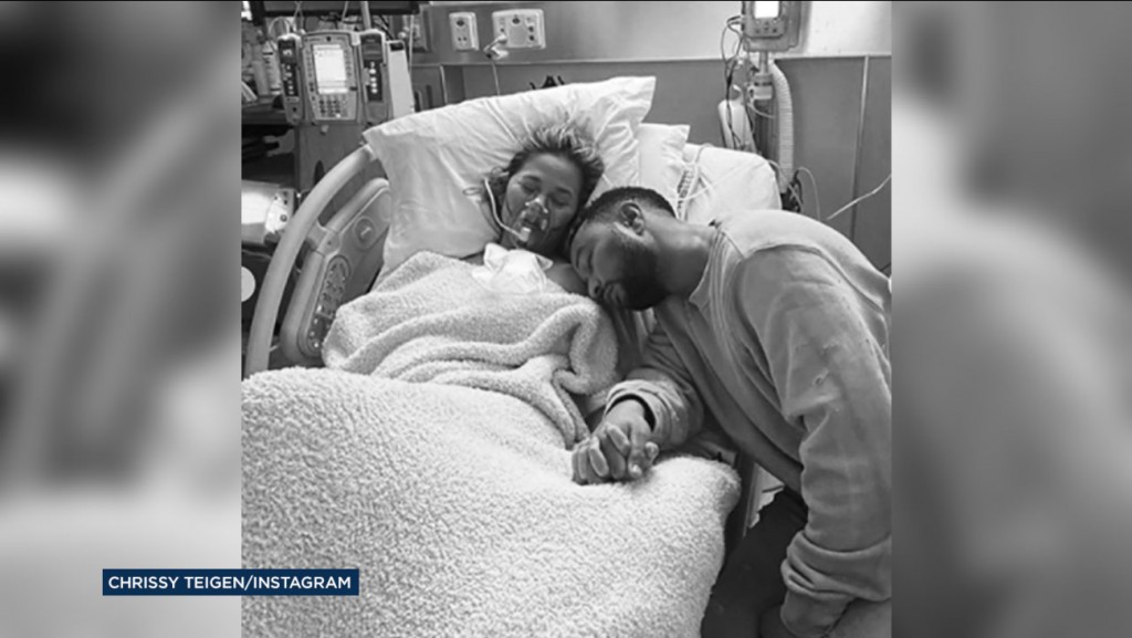 Chrissy Teigen and John Legend Lose Baby After Pregnancy Complications