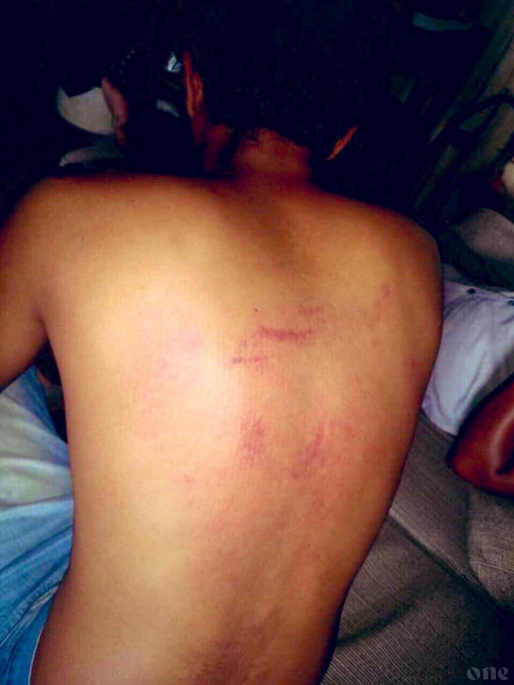 Police torture victim's photos hit social media, calls to arrest officers immediately