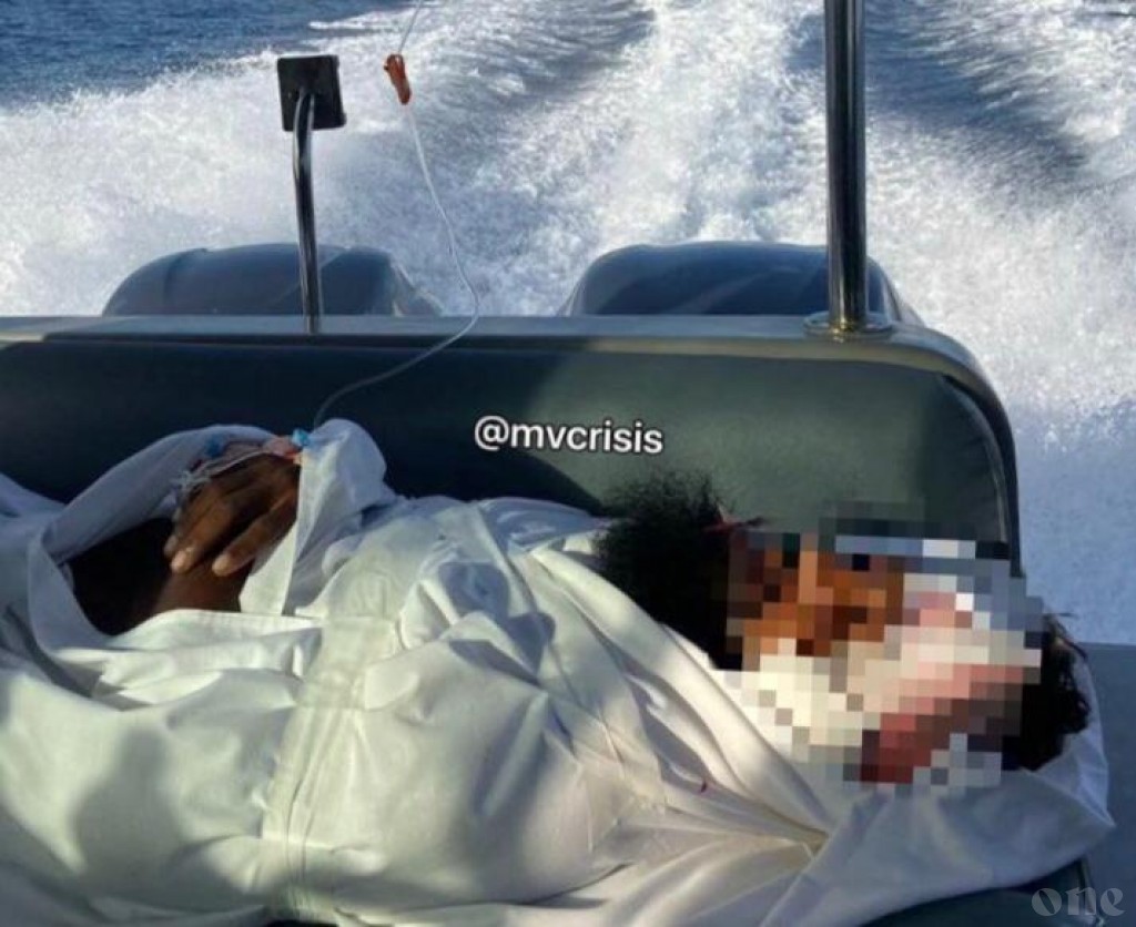 Local man thrown to sea with cuts in treatment in critical condition