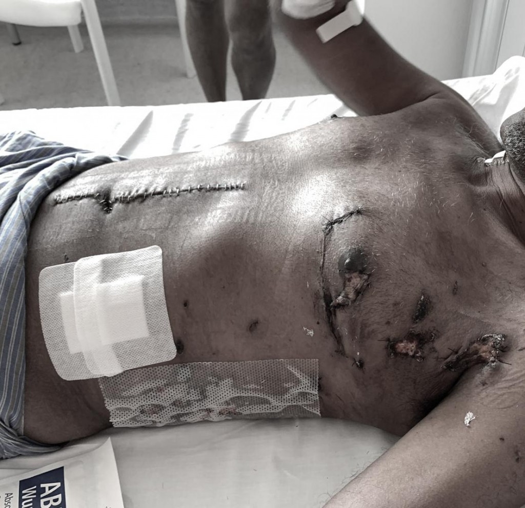 Raees Nasheed ge faige ithuru surgery eh kohfi
