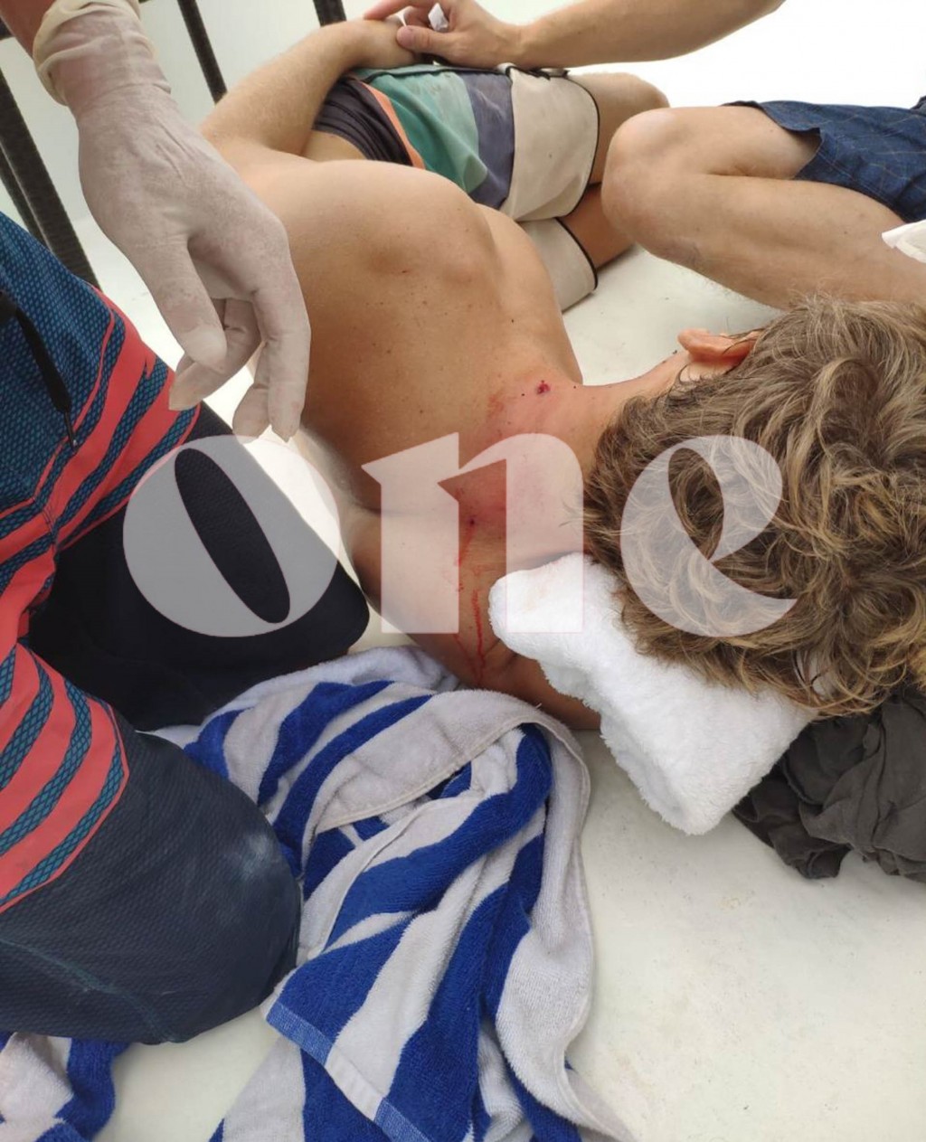 Bullet hit a tourist on the sun deck of safari, no serious injuries