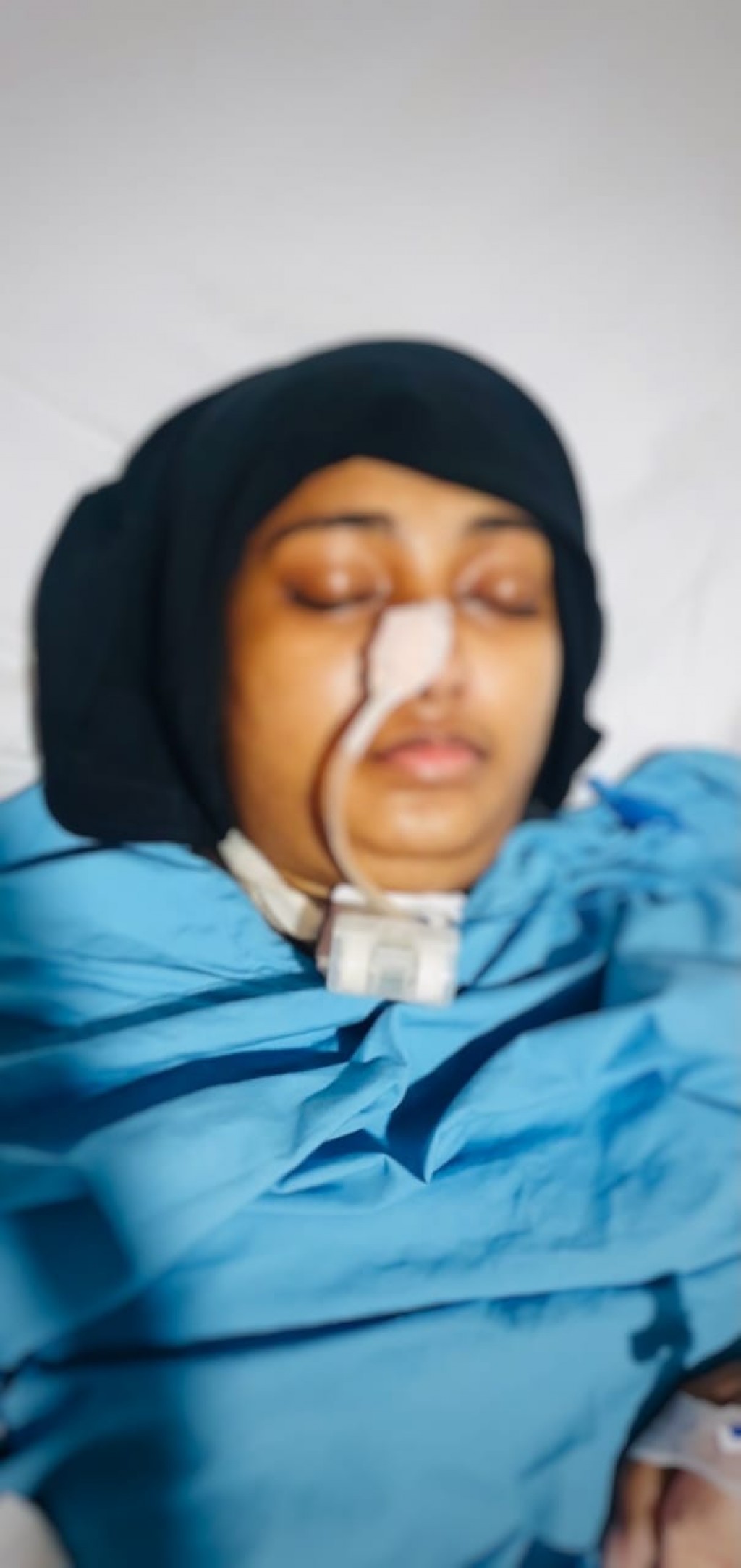 Ekaniveri maeh, Banahuge cream ah allergic vumun jehi injection ahffahu meehaa huhtti maraa hanguraama kuranee