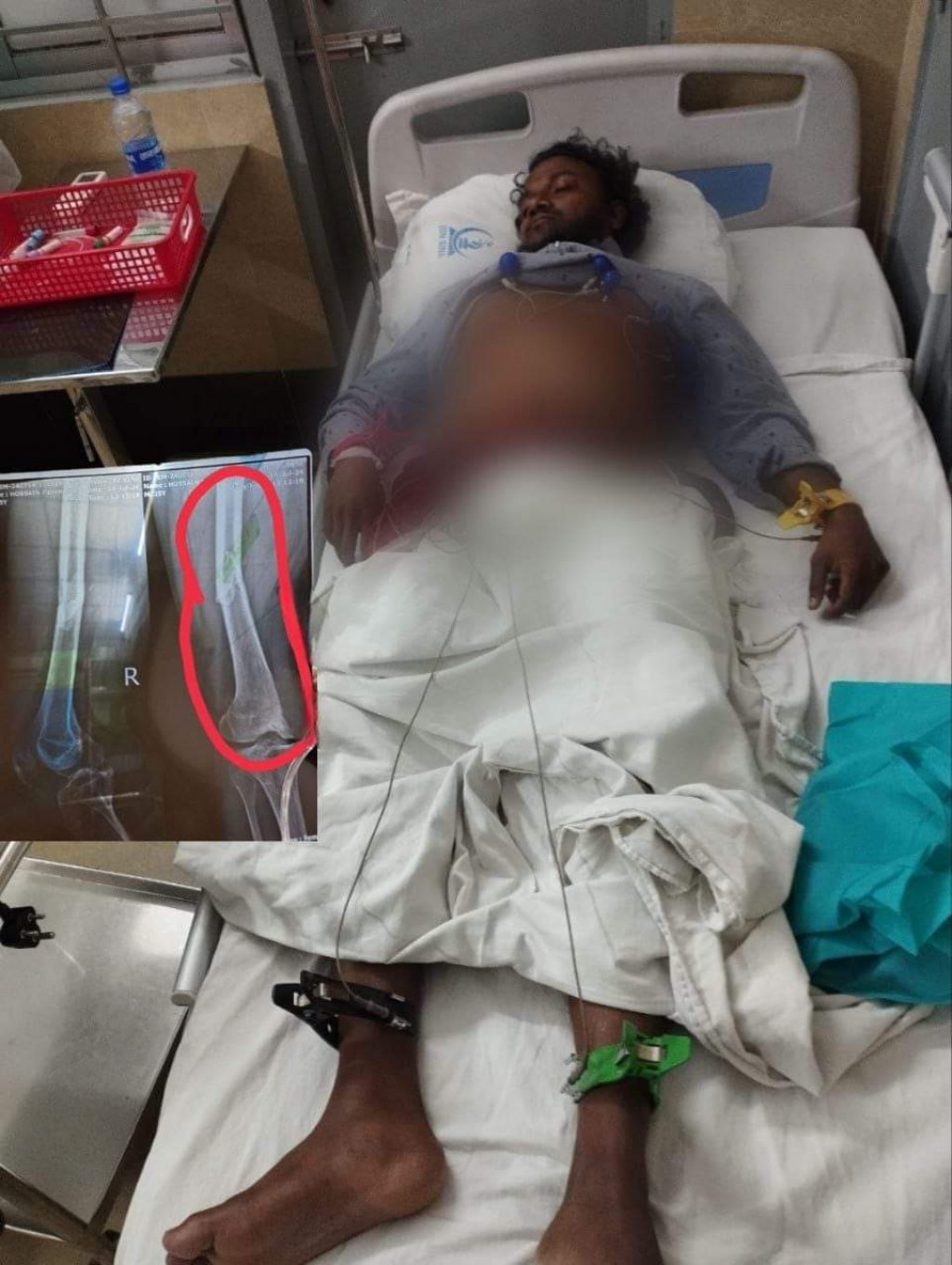 Bangladesh gai hingi accident ehgai dhivessakah bodu aniyaa eh