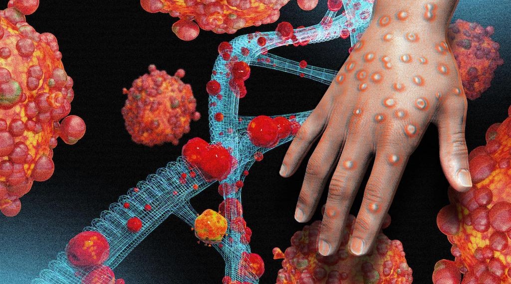 India in Mpox ge case eh fenijje