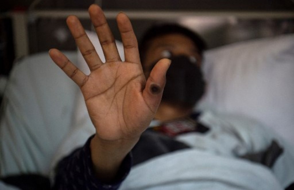 Raajje in Mpox ge case eh fenunu vaahaka HPA in dhogu koffi