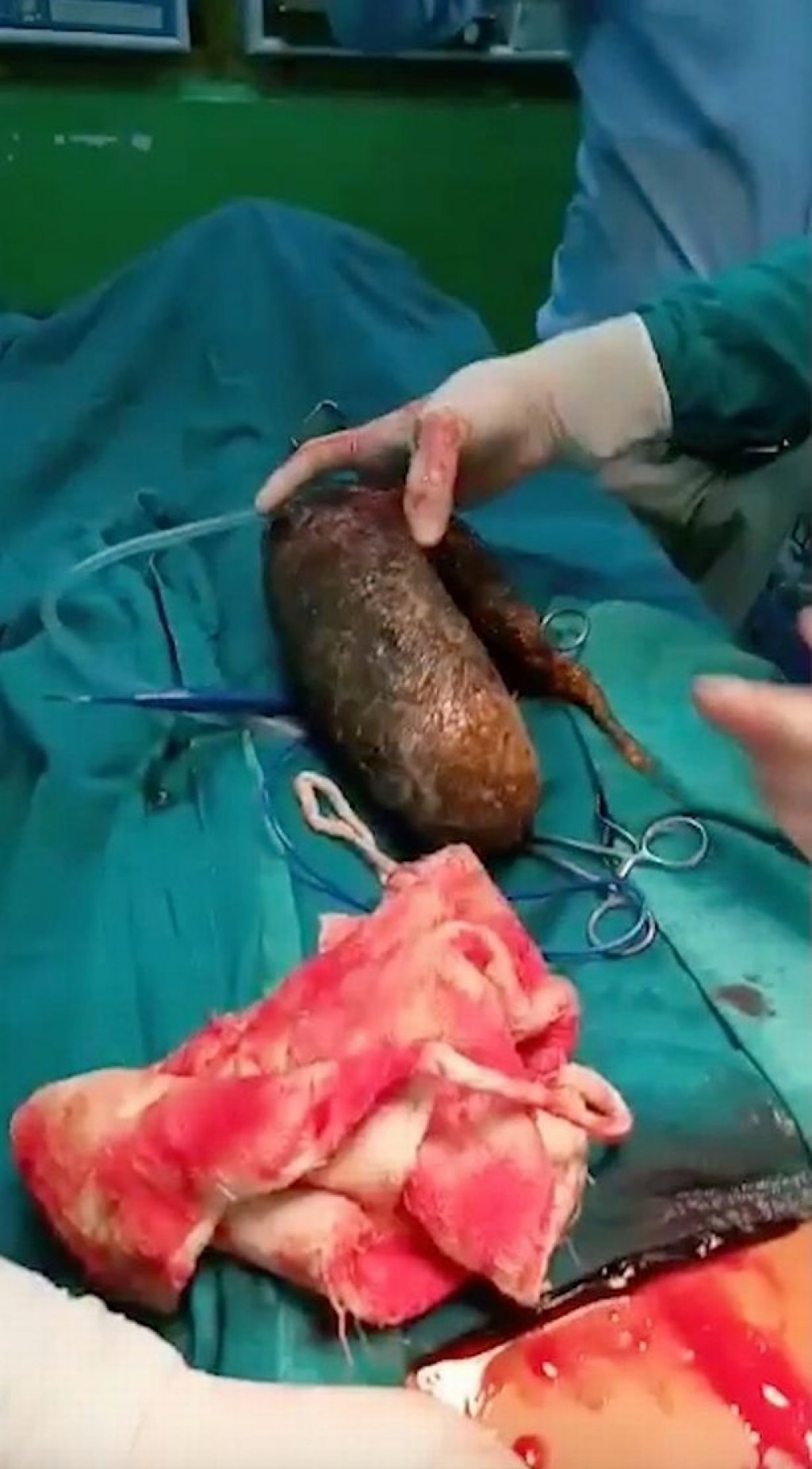 India kuhjjeh ge bandun 7 kg ge isthashi nagaifi