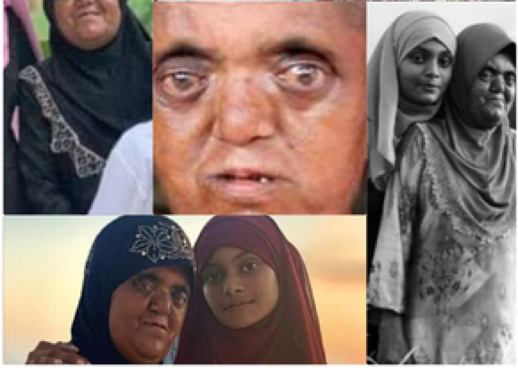 Sifa biruverivegen baakeekohlli Moonisa hurihaa mainnah namoonaa akah, kaamiyaabu anhendhariyehgge hero akah!