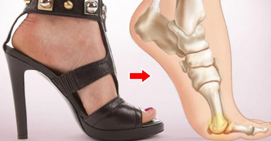 Abadhu High Heels gai ulhun rangalheh noon!