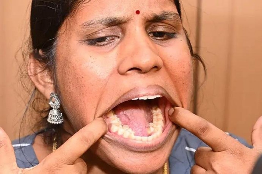 38 dhaii huri India anhenaku dhuniyey ge record fothah