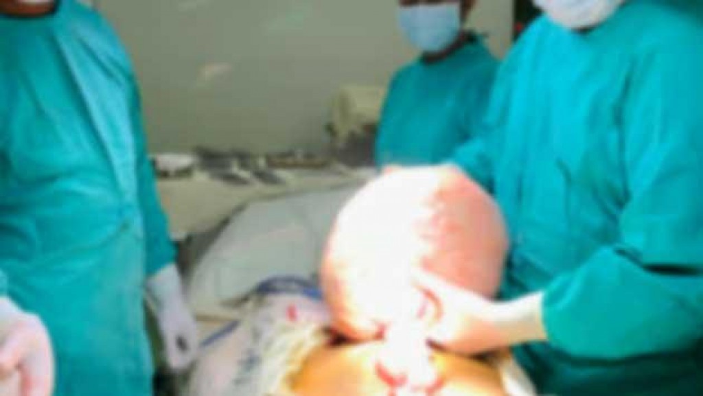 Lanka gai meehehgge rahimun 10 kilo ge tumor eh nagaifi