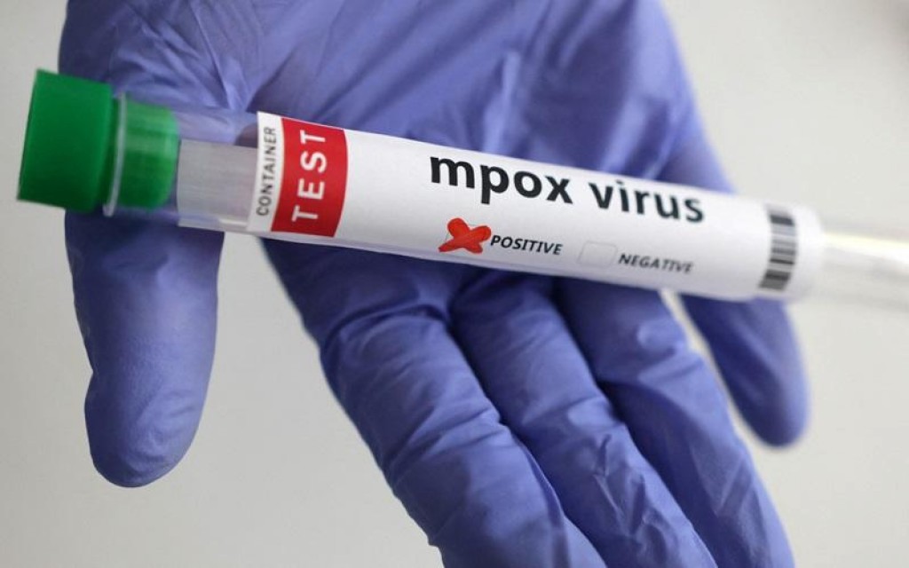 Kerala in fenifaivanee Mpox ge emme nurakkaatheri vahtharu