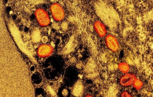 Droplets a 'minor' route for mpox transmission: WHO