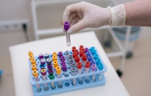 Oxford in ufahdhaa HIV vaccine ge ajuma belumuge thahuleelu thah fashaifi
