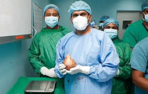 Enme bodu Kidney hila nagaifi, barudhanugai 801g huri