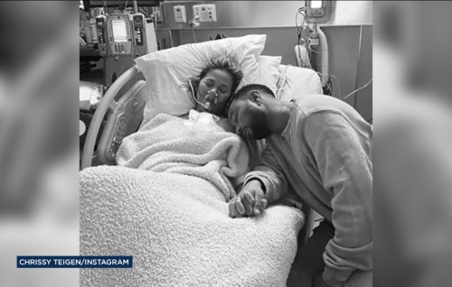 Chrissy Teigen and John Legend Lose Baby After Pregnancy Complications