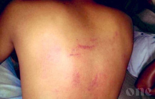 Police torture victim's photos hit social media, calls to arrest officers immediately