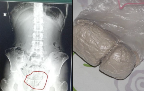 Furagas faraathugai foruvaigen Maafushi jalah etherekuran ulhunu drug athulaigenfi