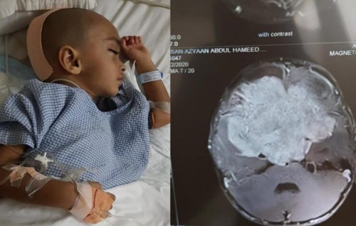 Lolutherein ufedhi boluthereyah boduvefaivaa tumor eh, thuthu dharifulhu salaamaiy kuran dhemafiriyaku vamun anna gurubaanee