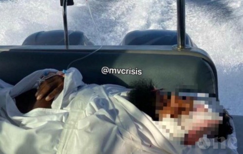 Local man thrown to sea with cuts in treatment in critical condition