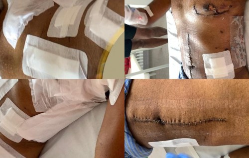 Photos of President Nasheed's injuries publicised