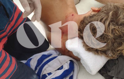 Bullet hit a tourist on the sun deck of safari, no serious injuries