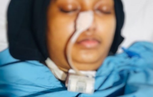Ekaniveri maeh, Banahuge cream ah allergic vumun jehi injection ahffahu meehaa huhtti maraa hanguraama kuranee