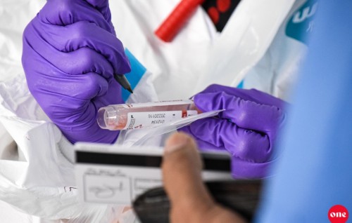 1,000 positive cases today, 206 from Male'