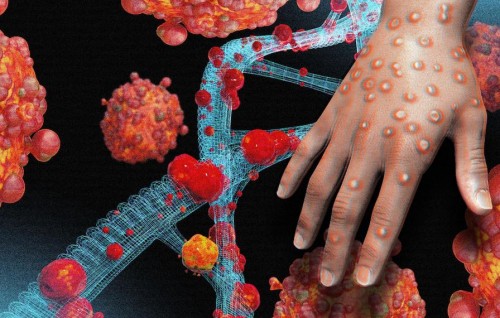 India in Mpox ge case eh fenijje