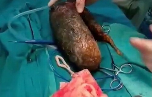 India kuhjjeh ge bandun 7 kg ge isthashi nagaifi
