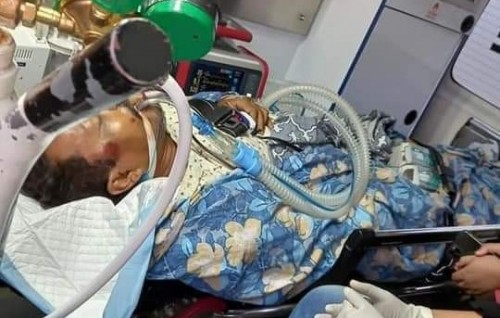 Addugai cycle in vettunu meehehge haalu serious ve ventilatorugai faruvaa dhenee
