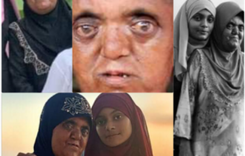 Sifa biruverivegen baakeekohlli Moonisa hurihaa mainnah namoonaa akah, kaamiyaabu anhendhariyehgge hero akah!