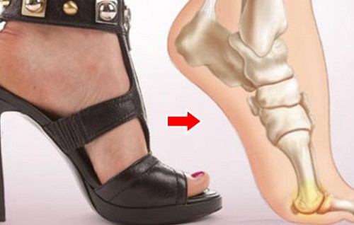 Abadhu High Heels gai ulhun rangalheh noon!