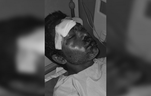 India gai hingi accidentehgai dhivessakah serious aniyaa thakeh: loluge kalhi nuhifehettey