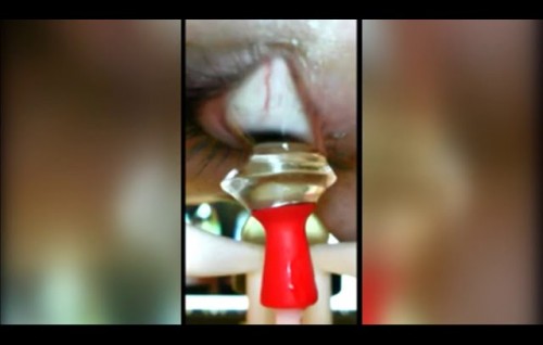 Florida meehaku Contact Lens lahvvaidhey robot eh ufaddhaifi