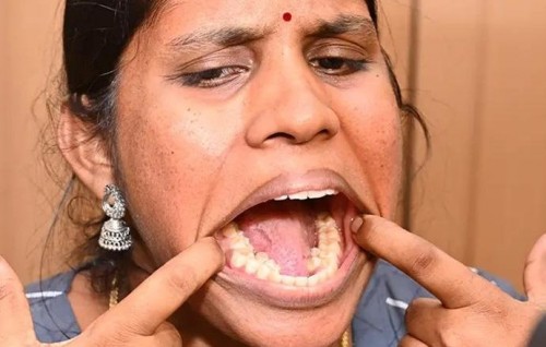 38 dhaii huri India anhenaku dhuniyey ge record fothah