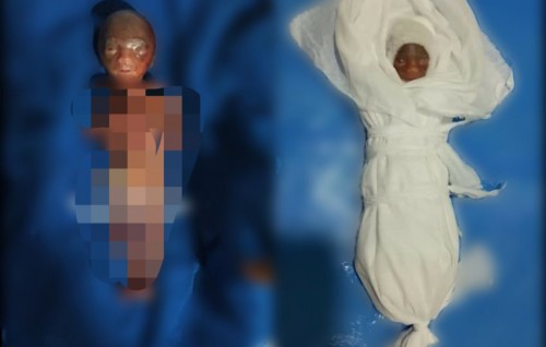 IGMH ah vihey kujjaku gasdhugai maraali kamuge thuhumathaa eku massala balanee