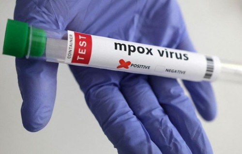 Kerala in fenifaivanee Mpox ge emme nurakkaatheri vahtharu